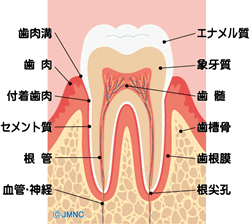 虫歯の基礎知識